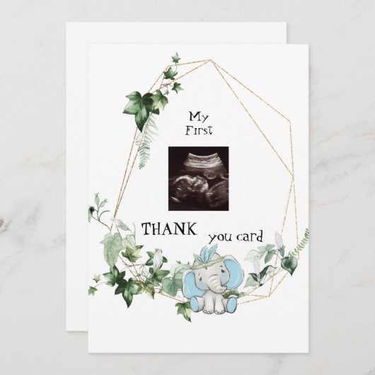 Niedliches Ultraschallgerät dank Baby Boy Viewpoin Dankeskarte (Vorne/Hinten)