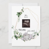 Niedliches Ultrasound Danke Baby Viewpoint (Vorderseite)