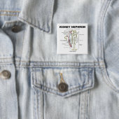 Niere Nephron Button (Beispiel)