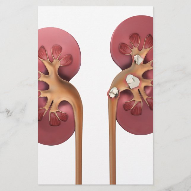 Nieren (Vorderseite)