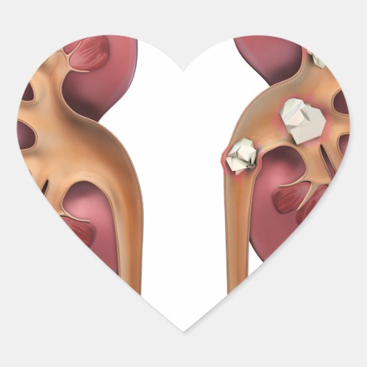 Nieren Herz-Aufkleber (Vorderseite)