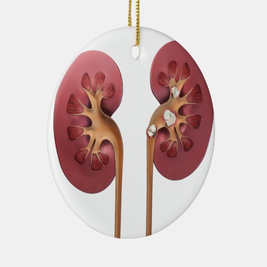 Nieren Keramikornament (Rechts)