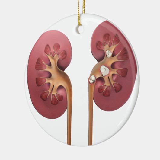 Nieren Keramikornament (Links)