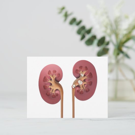 Nieren Postkarte (Stehend Vorderseite)
