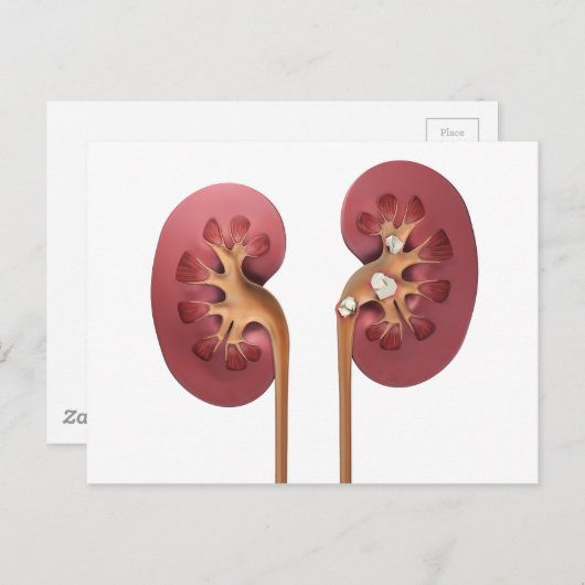 Nieren Postkarte (Vorne/Hinten)