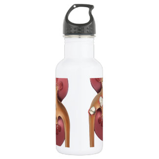 Nieren Trinkflasche