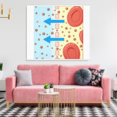 Nierendialyse Leinwanddruck (Insitu (Wohnzimmer))