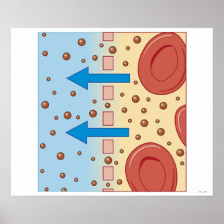 Nierendialyse Poster