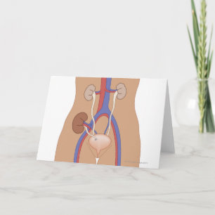 Nierentransplantation Karte