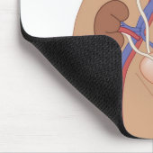 Nierentransplantation Mousepad (Ecke)