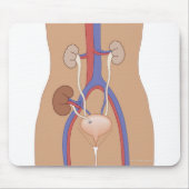 Nierentransplantation Mousepad (Vorne)