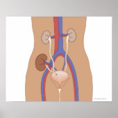 Nierentransplantation Poster (Vorne)