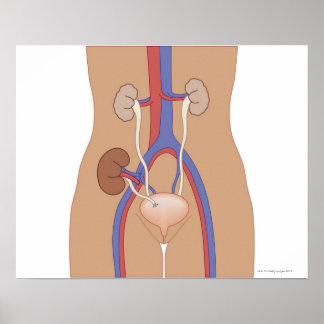 Nierentransplantation Poster