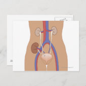 Nierentransplantation Postkarte (Vorne/Hinten)