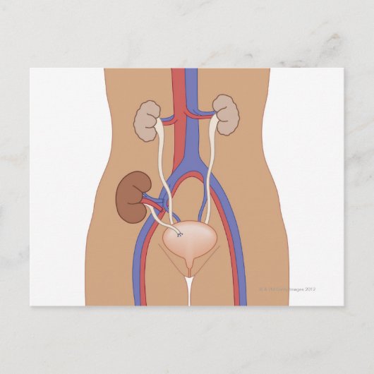 Nierentransplantation Postkarte (Vorderseite)