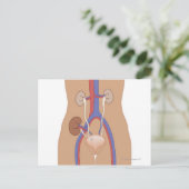 Nierentransplantation Postkarte (Stehend Vorderseite)