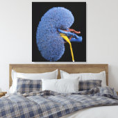 Nierenzirkulation Leinwanddruck (Insitu (Schlafzimmer))
