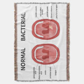 Normal bakteriell decke (Vorderseite Vertikal)