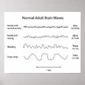 Normale erwachsene Hirnwellen Eeg Poster (Vorne)