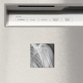 Normale Schulter. Röntgenaufnahme der gesunden lin Magnet (In Situ (Geschirrspüler))