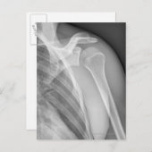 Normale Schulter. Röntgenaufnahme der gesunden lin Postkarte (Vorne/Hinten)