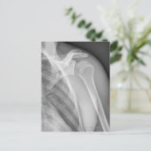 Normale Schulter. Röntgenaufnahme der gesunden lin Postkarte (Stehend Vorderseite)