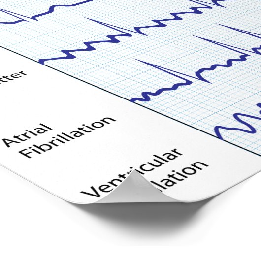 Normale und pathologische eca Poster (Ecke)