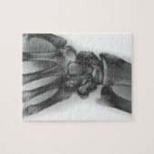 Normales Handgelenk, Röntgenaufnahme Puzzle (Horizontal)