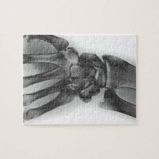 Normales Handgelenk, Röntgenaufnahme Puzzle (Horizontal)