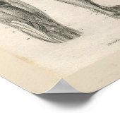 Oberschenkelmuskeln Vintage Anatomie Druck Poster (Ecke)