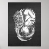 OBGYN Anatomy Art Decor Nr. 3 Poster (Vorne)