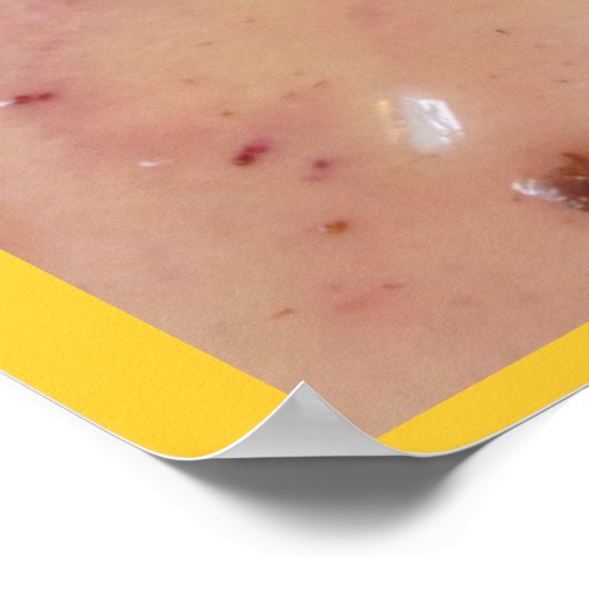 Obst und Toast Poster (Ecke)