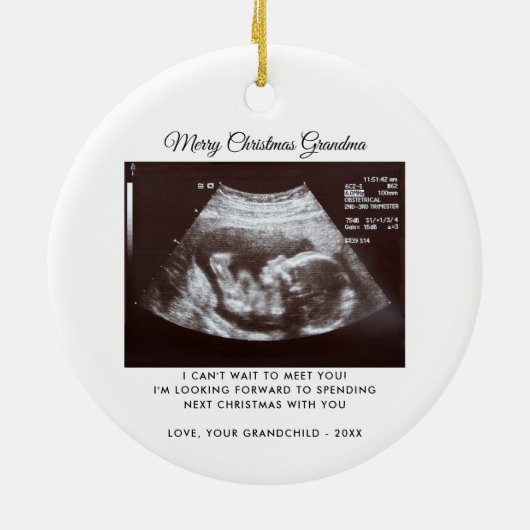 Oma Pregnancy Ankündigung Weihnachten Keepake Keramik Ornament (Hinten)