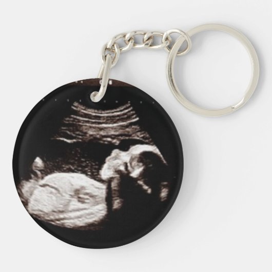 Oma to Be, Schwangerschaft Ankündigung Ultrasund Schlüsselanhänger (Rückseite)