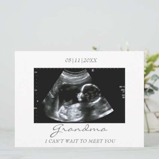 Oma's New Grandbaby Ultrasound Ankündigung (Stehend Vorderseite)