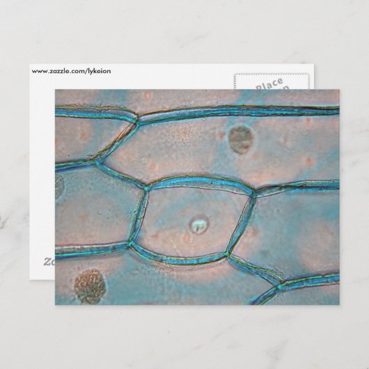 Onionenzellen unter dem Mikroskop Postkarte (Vorne/Hinten)