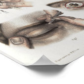 Operation der Augen Technik Vintage Anatomie Poster (Ecke)