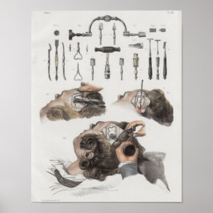 Operation der Gehirne Instrumente Vintag Anatomie Poster