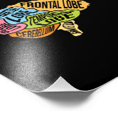 Operation der Hirnteile Doktor Neurologie Fotodruck (Ecke)