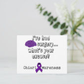 Operation des Gehirns Postkarte (Stehend Vorderseite)