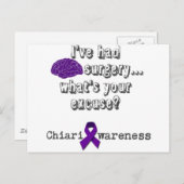 Operation des Gehirns Postkarte (Vorne/Hinten)