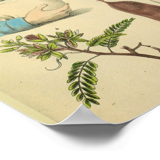 Operation Kopf Anatomie Art Doktor Print Poster (Ecke)