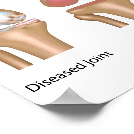 Operationen-Poster insgesamt Poster (Ecke)