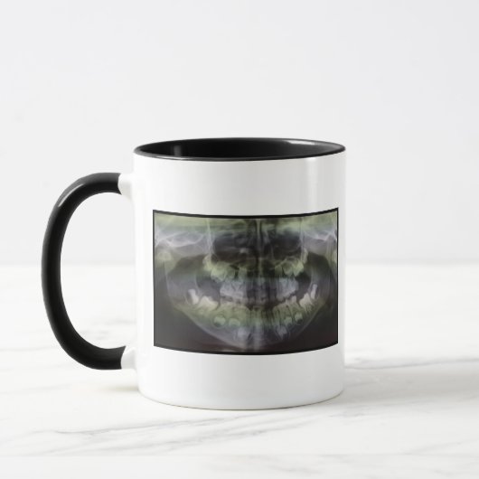 OPG Kaffee-Tasse Tasse (Links)