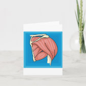 Organentzündung Karte (Vorderseite)