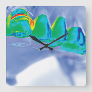 Original Teeth Design Dentist Wall Clock Quadratische Wanduhr