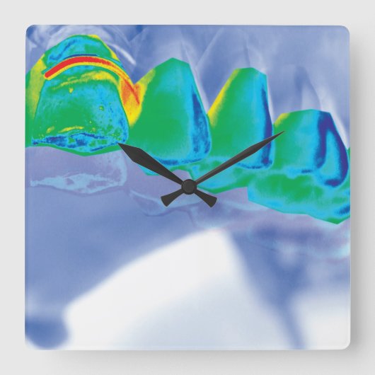 Original Teeth Design Dentist Wall Clock Quadratische Wanduhr (Vorderseite)