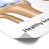 Osteoarthritis Kniegelenk-Poster Poster (Ecke)