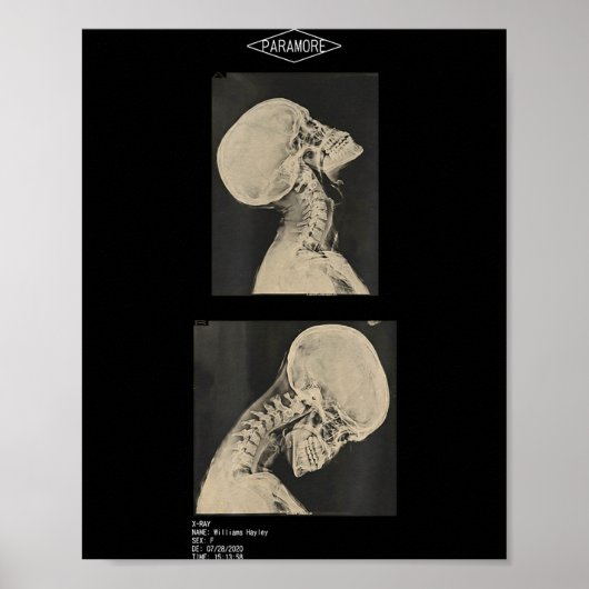 Paramore cropped headbanger Röntgenärzte Poster (Vorne)