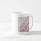 Parasitärer Fadenwurmwurm (Ascarid-SP.) Kaffeetasse (VorderseiteRechts)